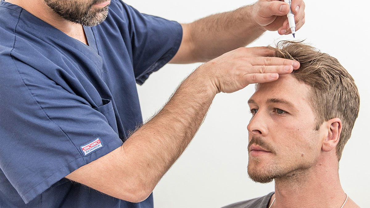 نحوه مراقبت بعد از کاشت مو چگونه است؟ + رعایت ۶ نکته اصلی