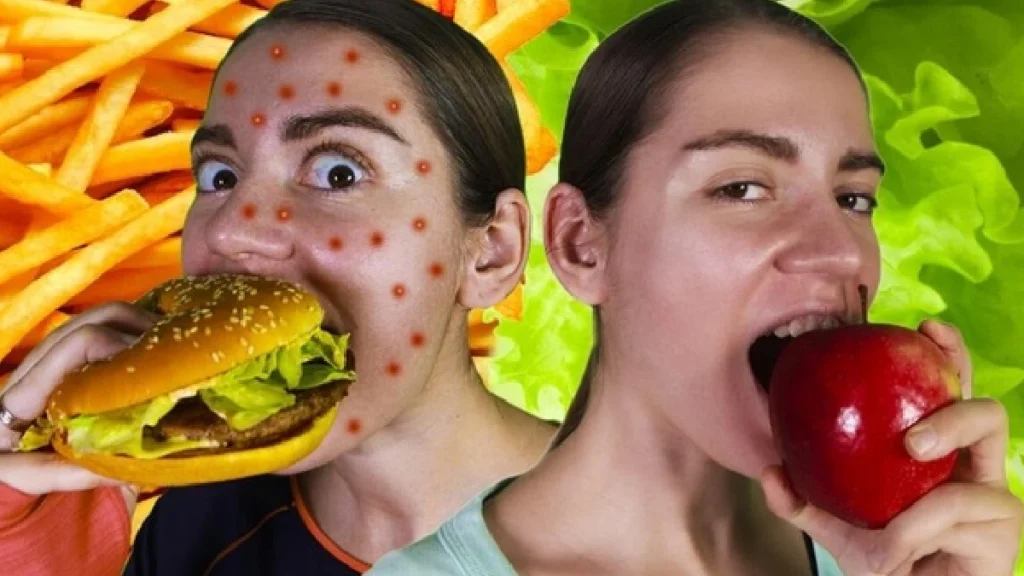 از بین بردن جوش در یک شب