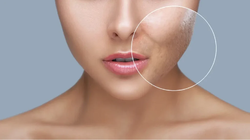 آیا آبرسان منافذ پوست را باز میکند؟