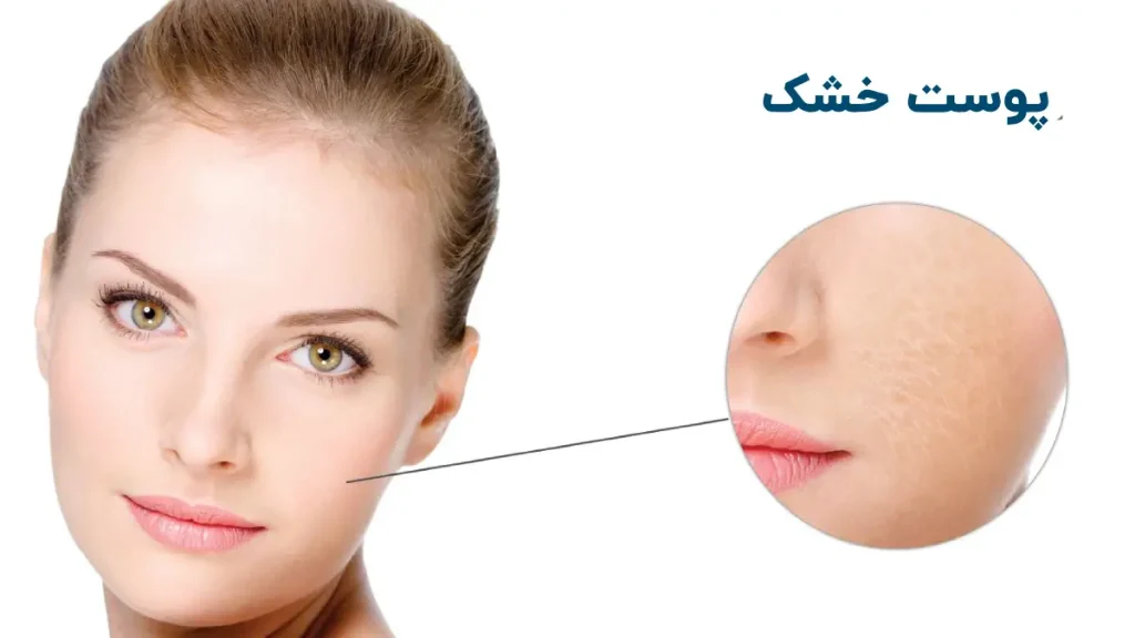 راهنمای کامل انواع پوست