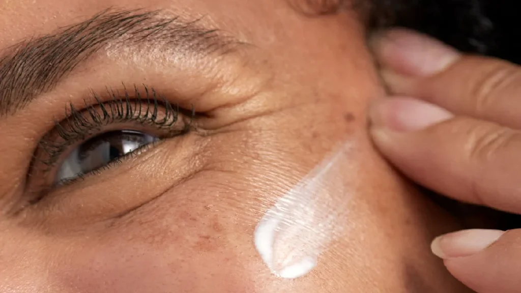 چروک پنجه کلاغی دور چشم