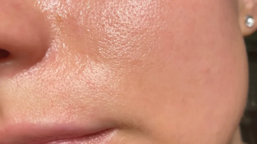 بهترین شوینده برای پوست چرب با منافذ باز