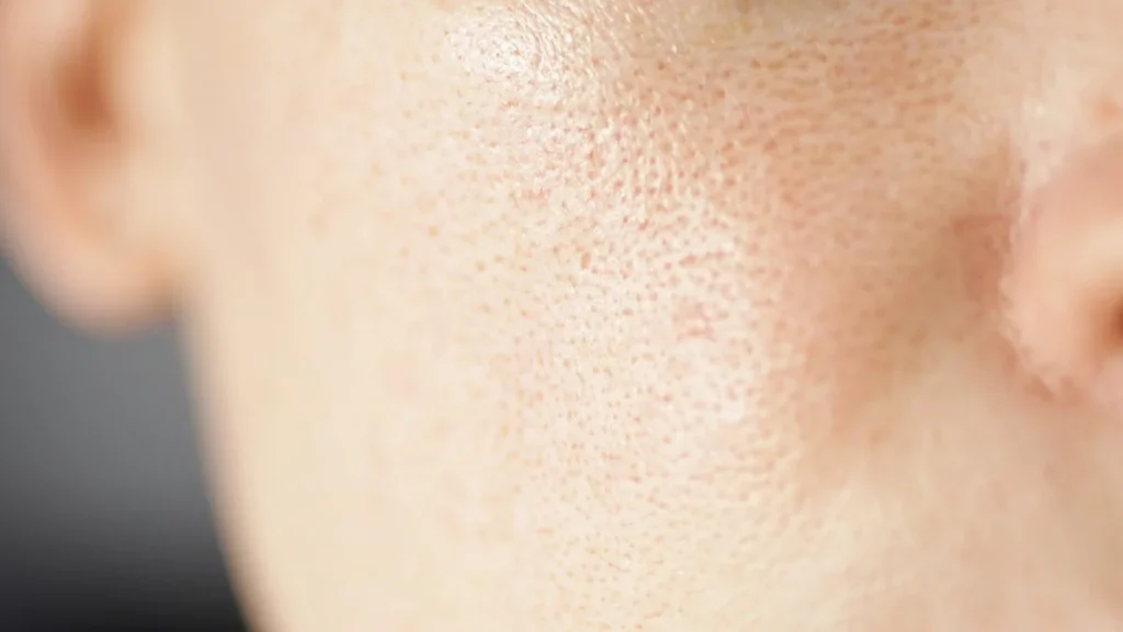 بهترین شوینده برای پوست چرب با منافذ باز