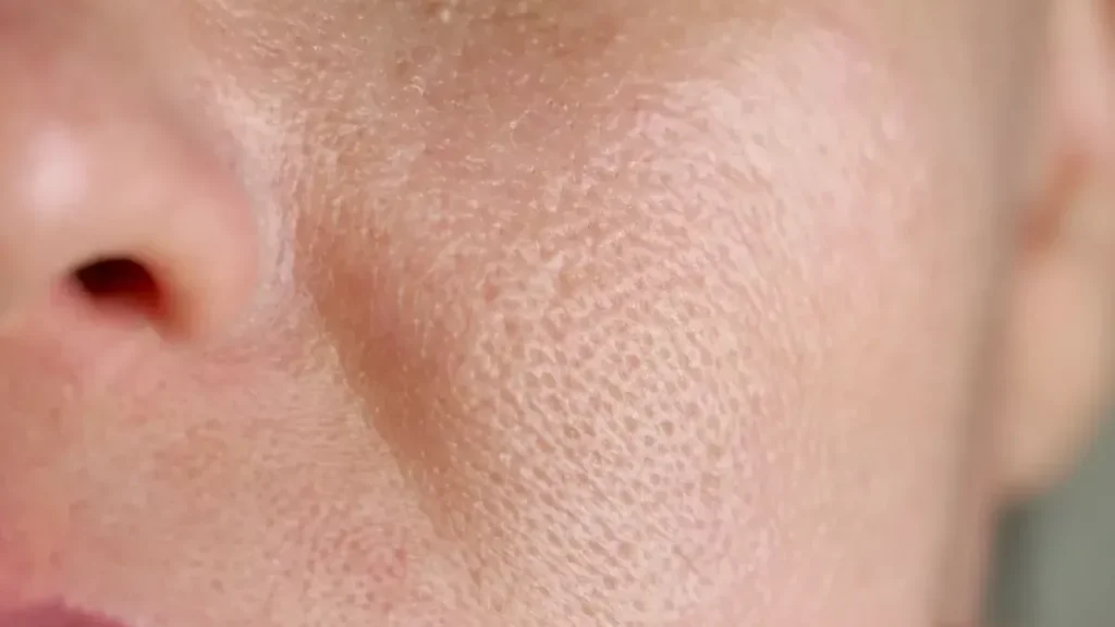 بهترین شوینده برای پوست چرب با منافذ باز