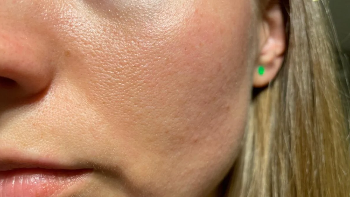 بهترین شوینده برای پوست چرب با منافذ باز