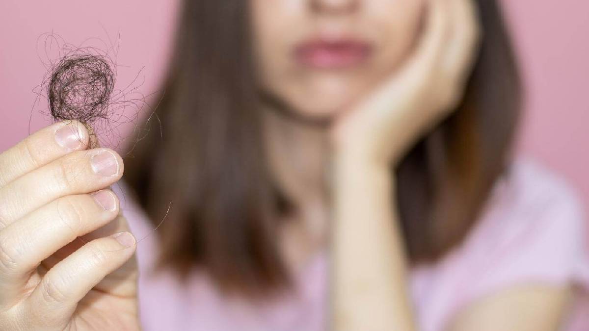 بهترین درمان دارویی برای ریزش مو هورمونی