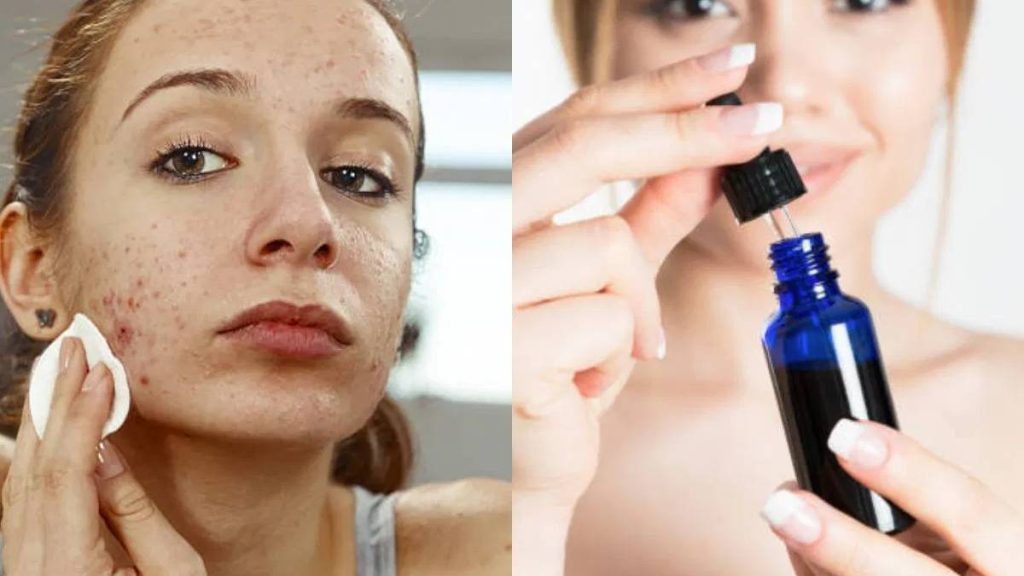 سالیسیلیک اسید