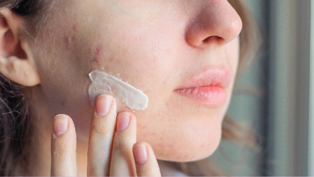 سالیسیلیک اسید