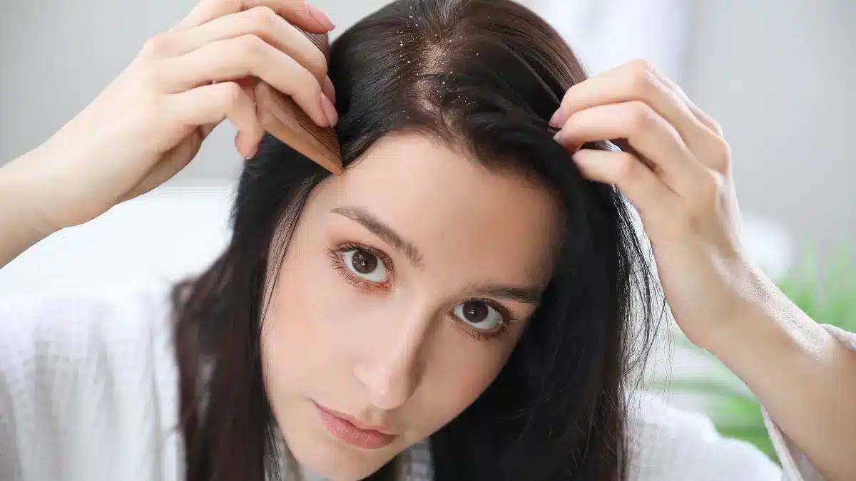 بهترین شامپو برای خشکی پوست سر ۱۴۰۵