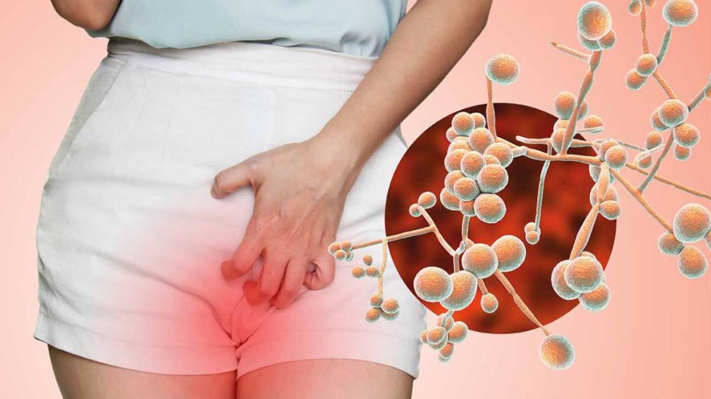آیا ژل لوبریکانت باعث عفونت میشود؟