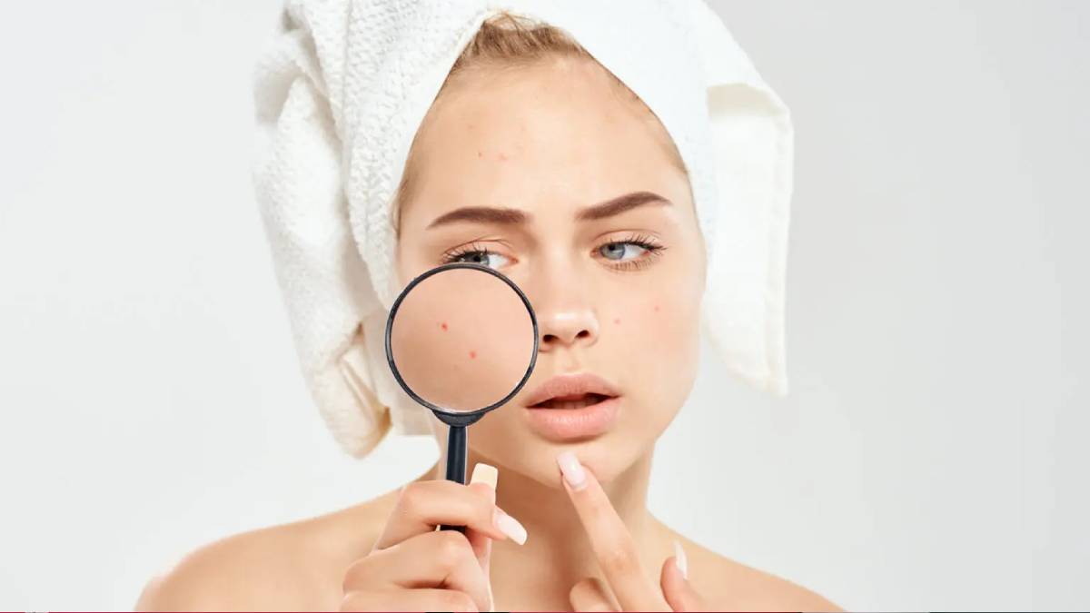 آیا تونر باعث جوش میشود؟