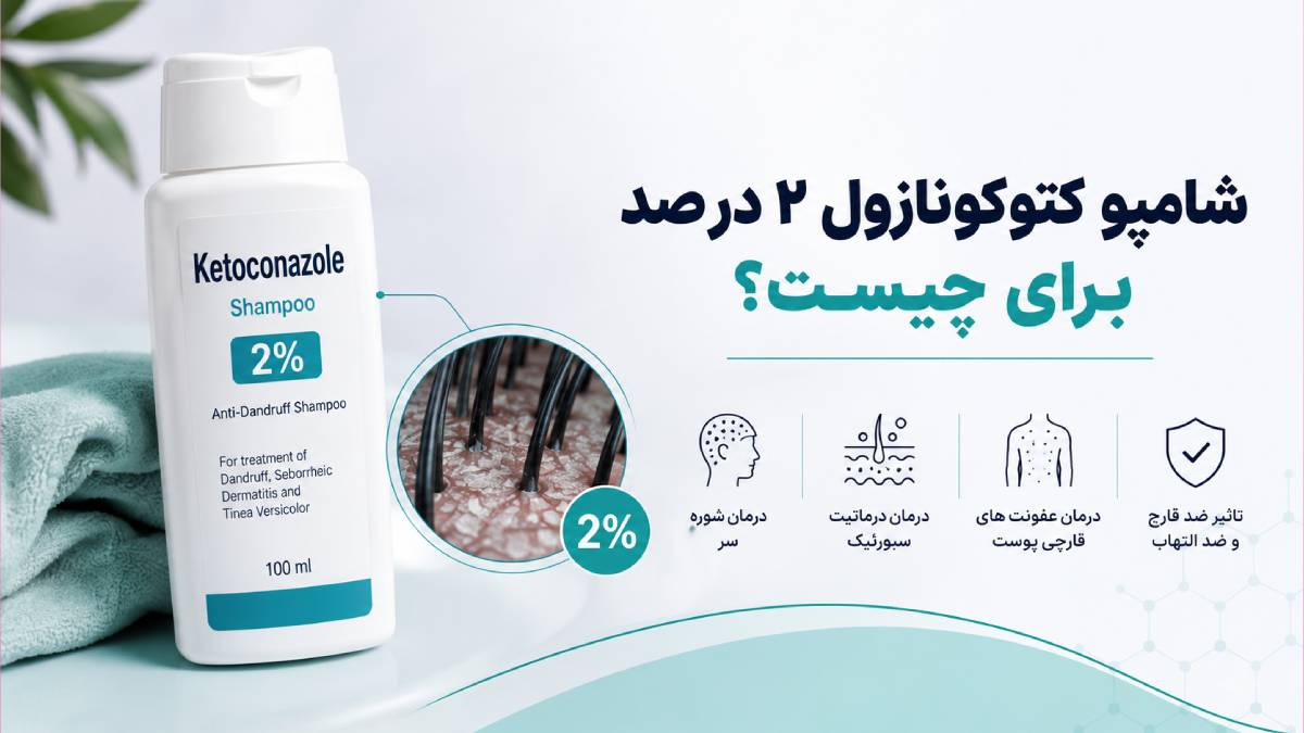 شامپو کتوکونازول ۲ درصد برای چیست؟