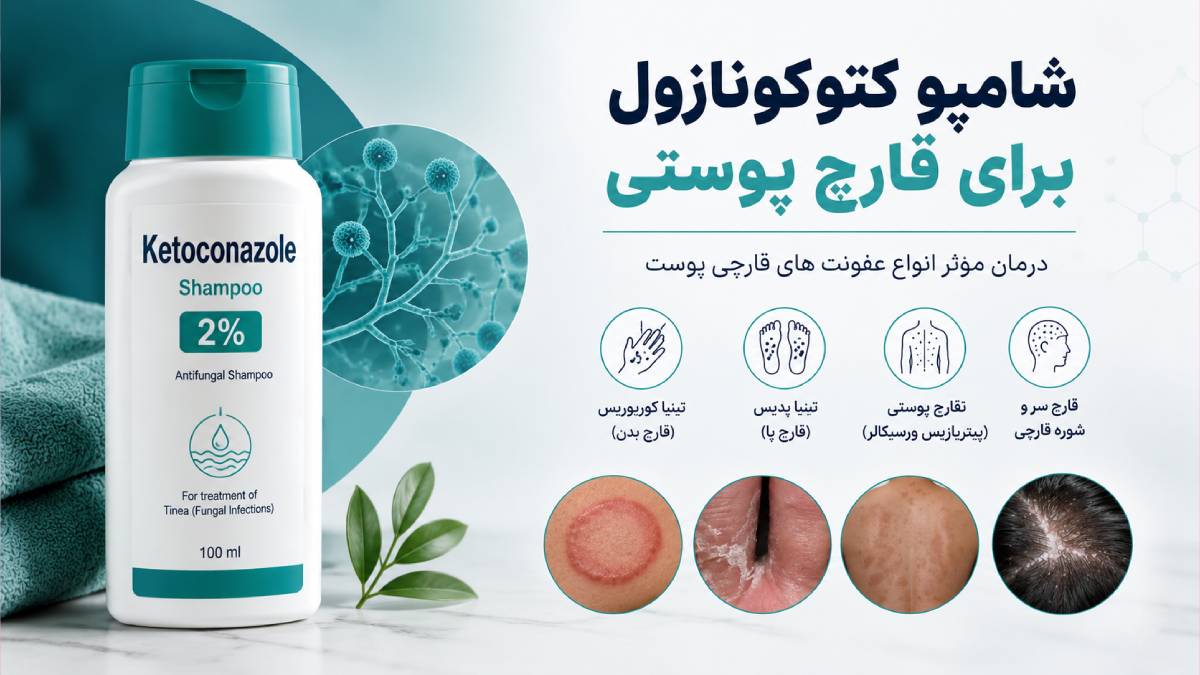 شامپو کتوکونازول برای قارچ پوستی