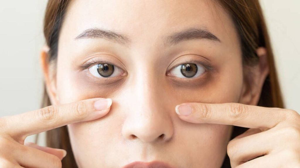 برای سیاهی دور چشم چی خوبه؟