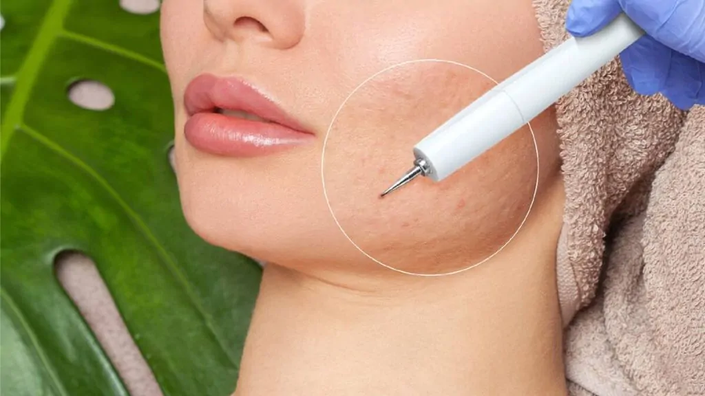 PDRN چیست و چه کاربردی برای پوست دارد؟